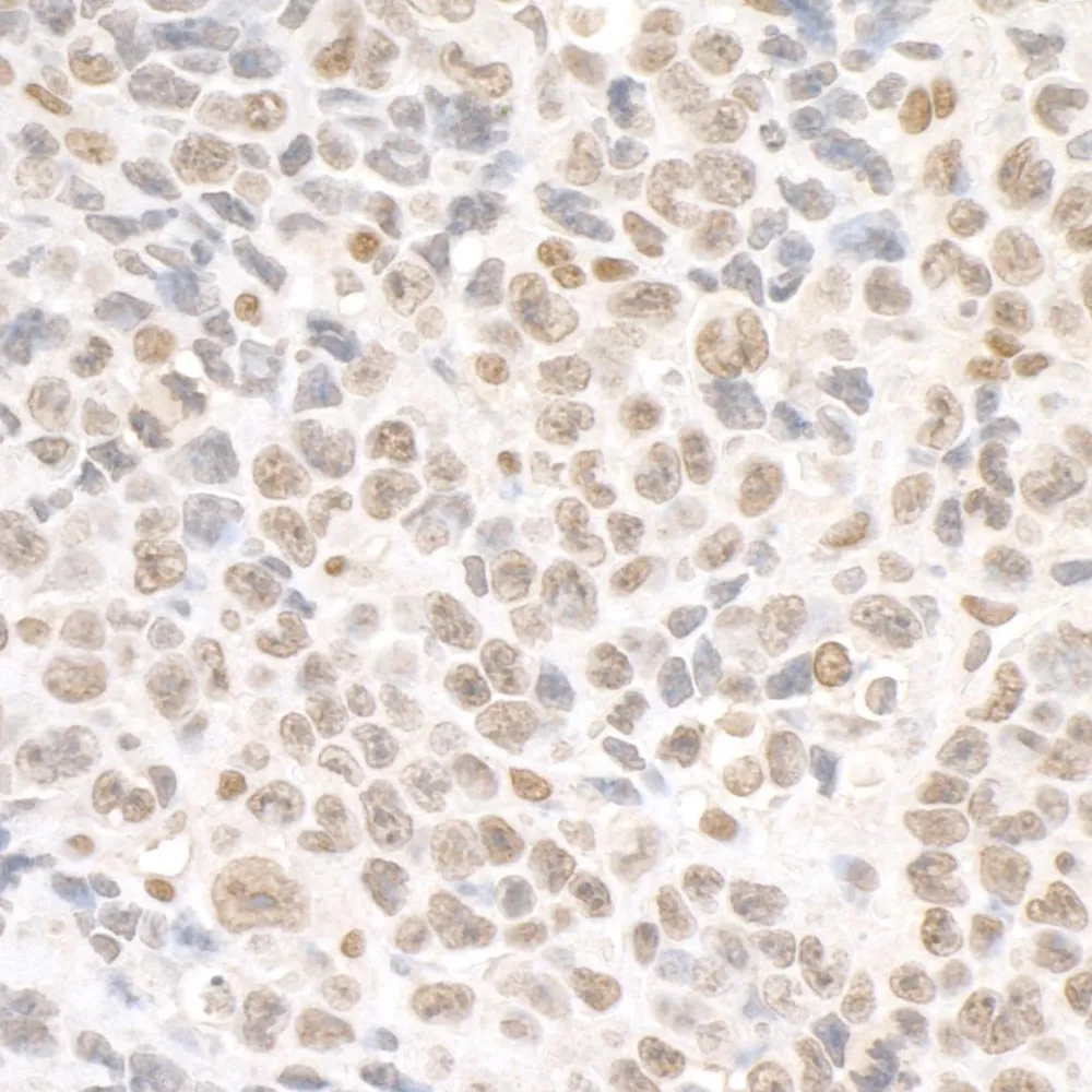 Rabbit anti-SMC1 Antibody, Affinity Purified