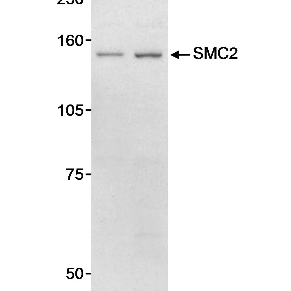 Rabbit anti-SMC2 Antibody, Affinity Purified
