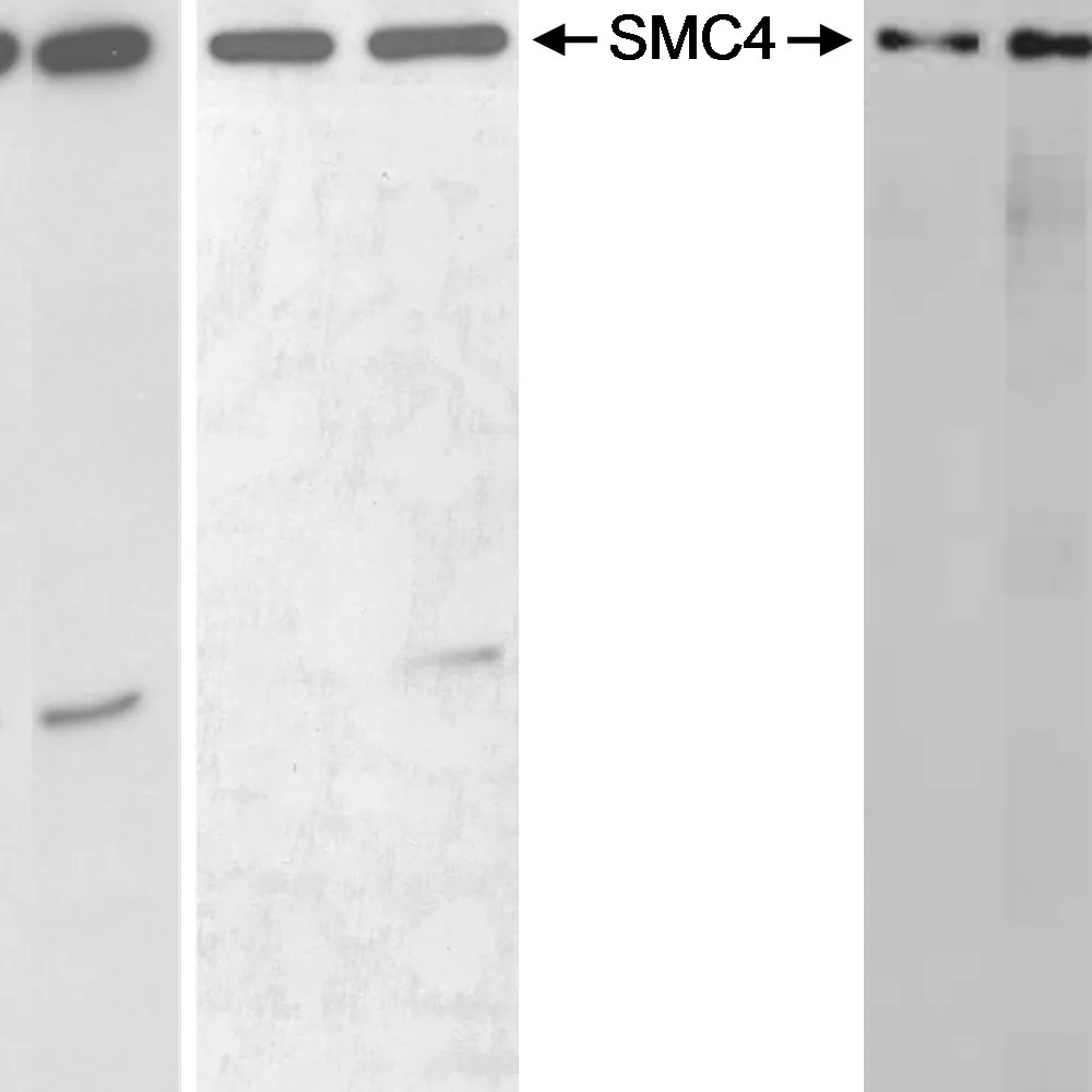 Rabbit anti-SMC4 Antibody, Affinity Purified