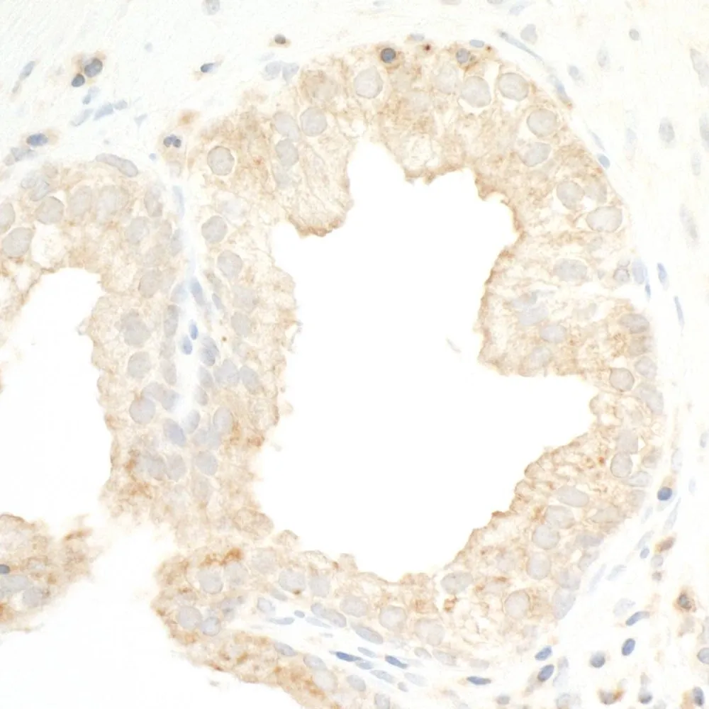 Rabbit anti-PKD2 Antibody, Affinity Purified
