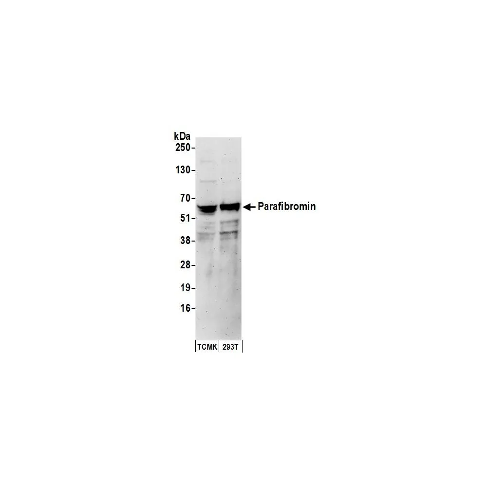 Rabbit anti-Parafibromin Antibody, Affinity Purified