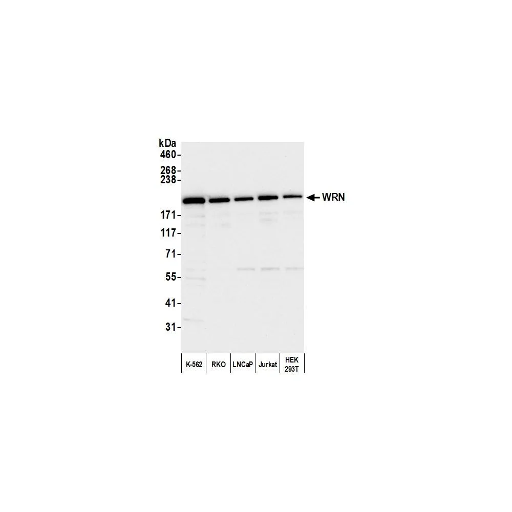 Rabbit anti-WRN Antibody, Affinity Purified