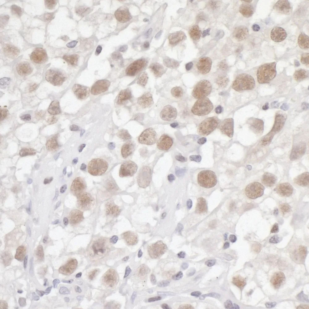 Rabbit anti-Fen1 Antibody, Affinity Purified