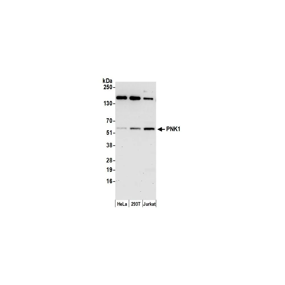 Rabbit anti-PNK1 Antibody, Affinity Purified