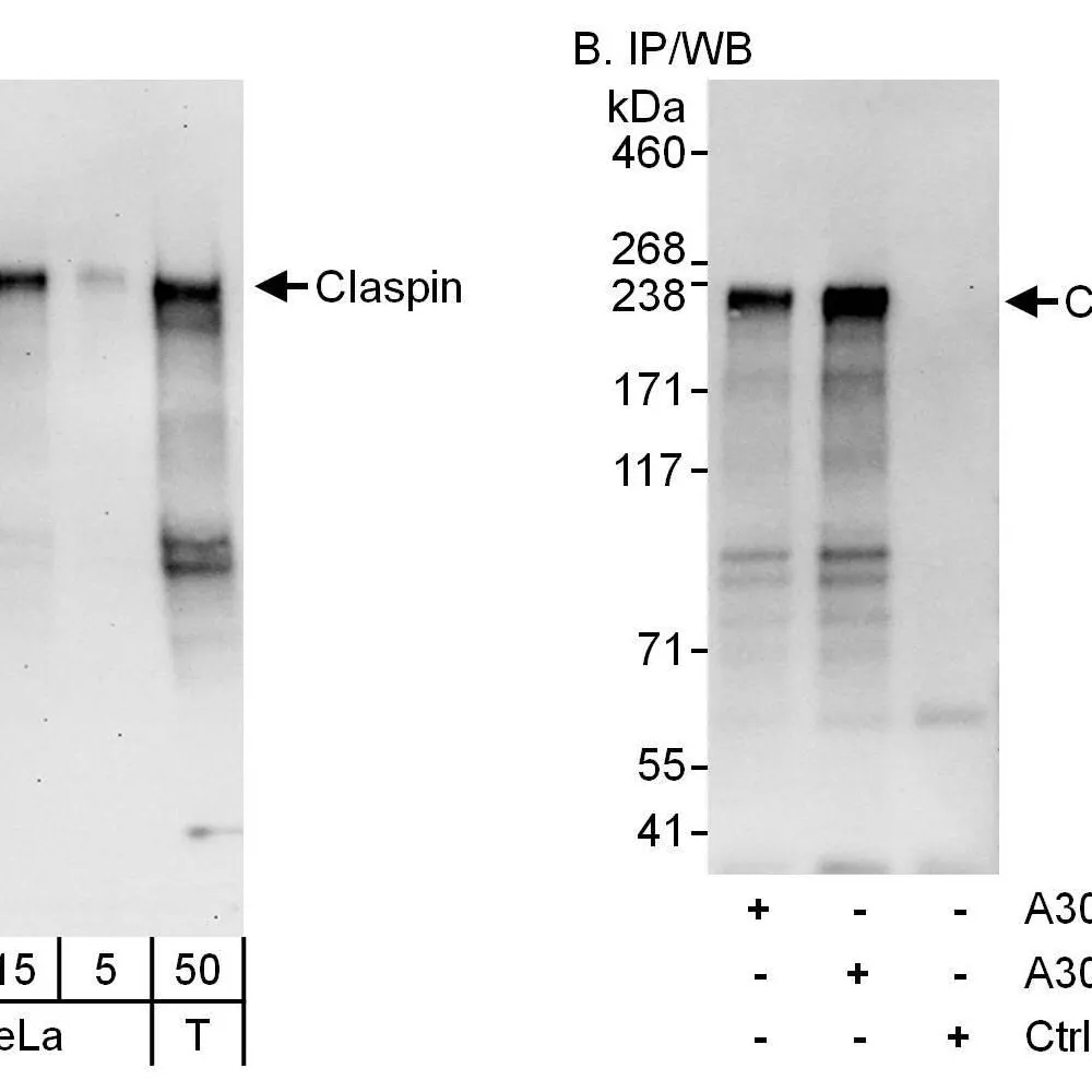 Rabbit anti-Claspin Antibody, Affinity Purified