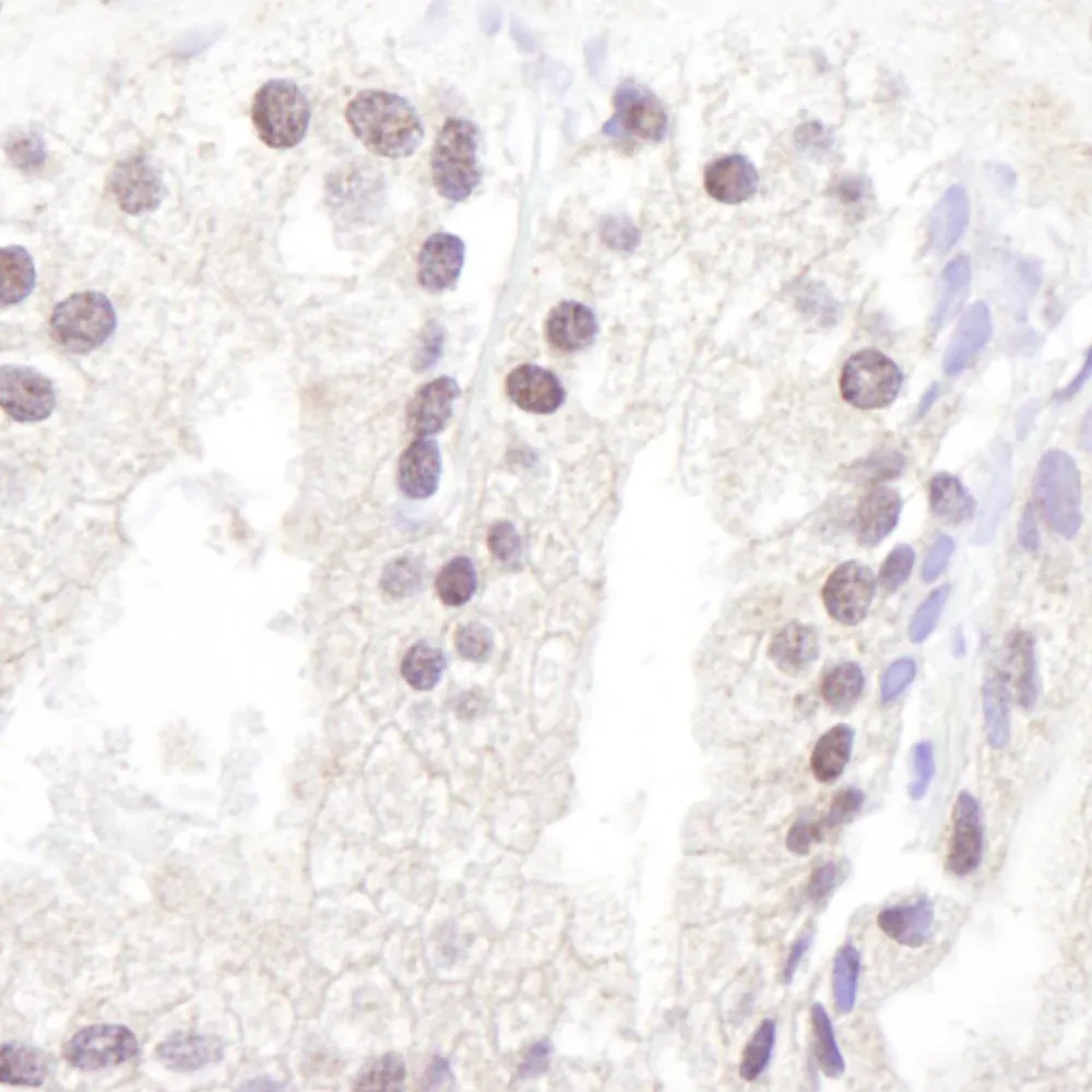 Rabbit anti-ATM Antibody, Affinity Purified