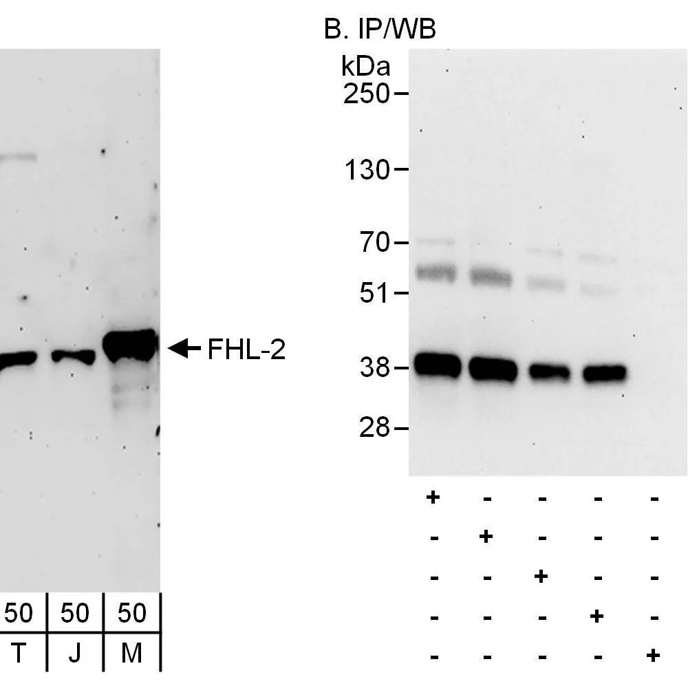 Rabbit anti-FHL2 Antibody, Affinity Purified