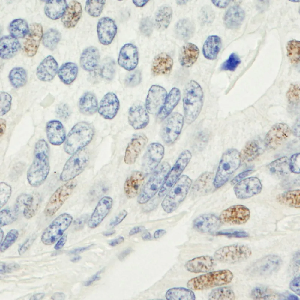 Rabbit anti-MAD1 Antibody, Affinity Purified