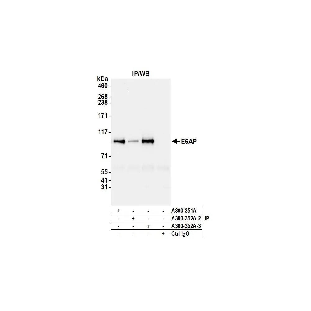 Rabbit anti-E6AP Antibody, Affinity Purified