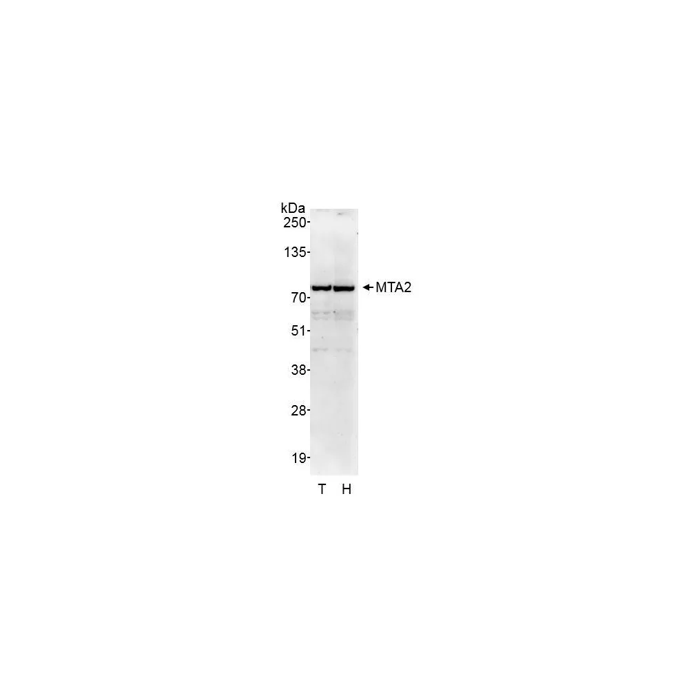 Rabbit anti-MTA2 Antibody, Affinity Purified