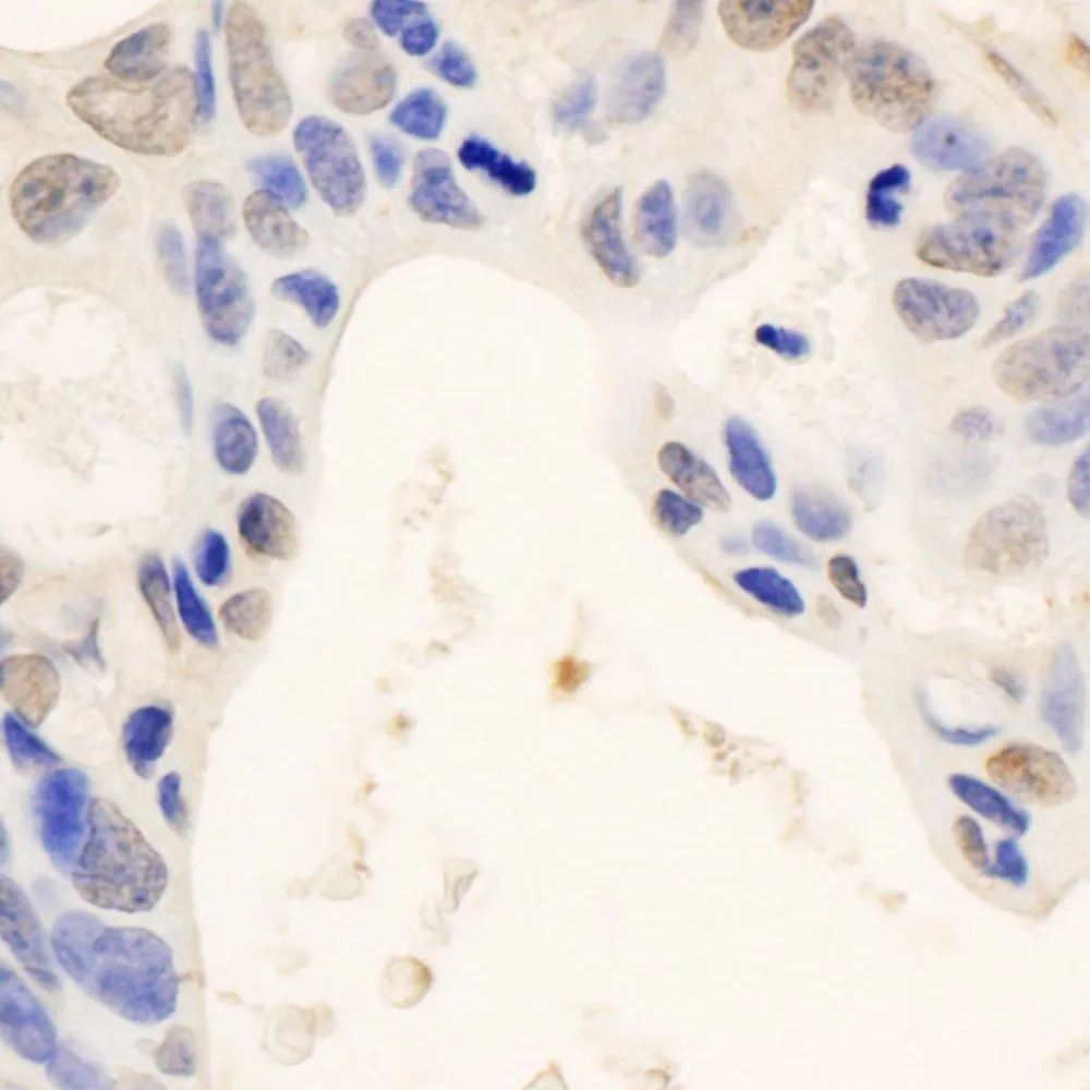 Rabbit anti-STAT6 Antibody, Affinity Purified