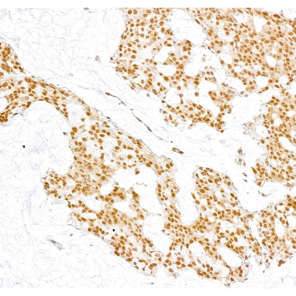 Rabbit anti-CARM1 Antibody, Affinity Purified