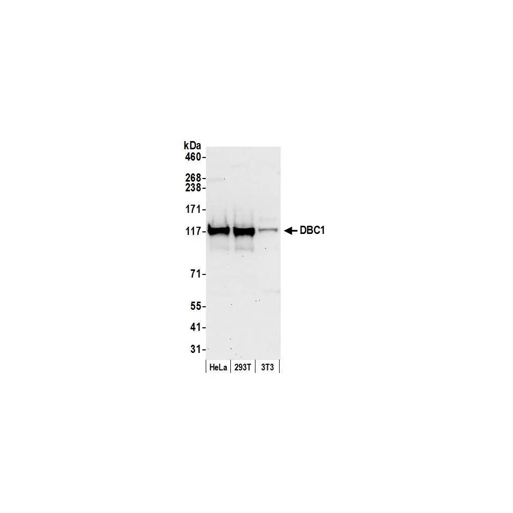 Rabbit anti-DBC1/p30 DBC Antibody, Affinity Purified
