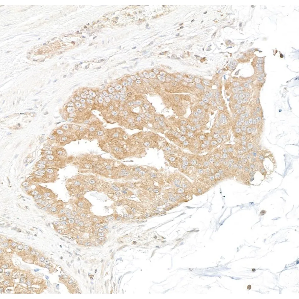 Rabbit anti-DDX6 Antibody, Affinity Purified