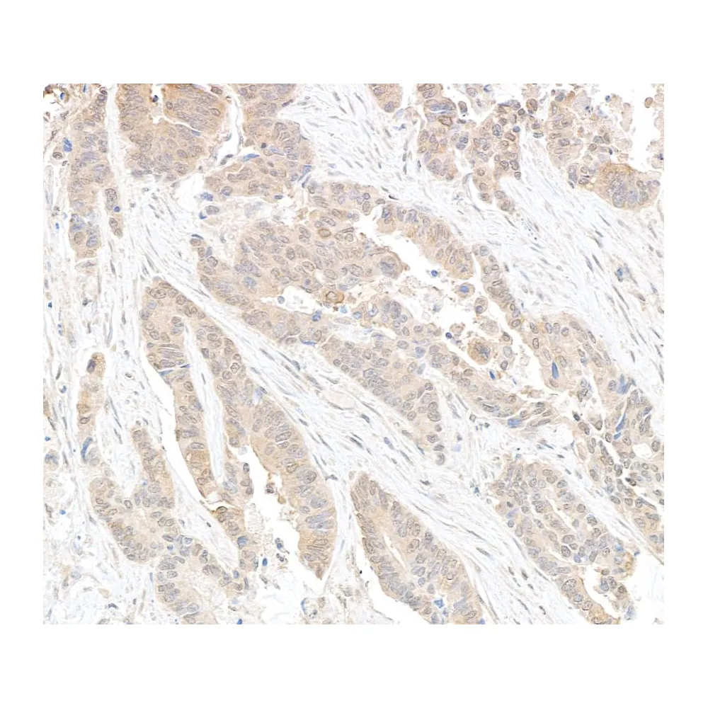 Rabbit anti-DDX6 Antibody, Affinity Purified