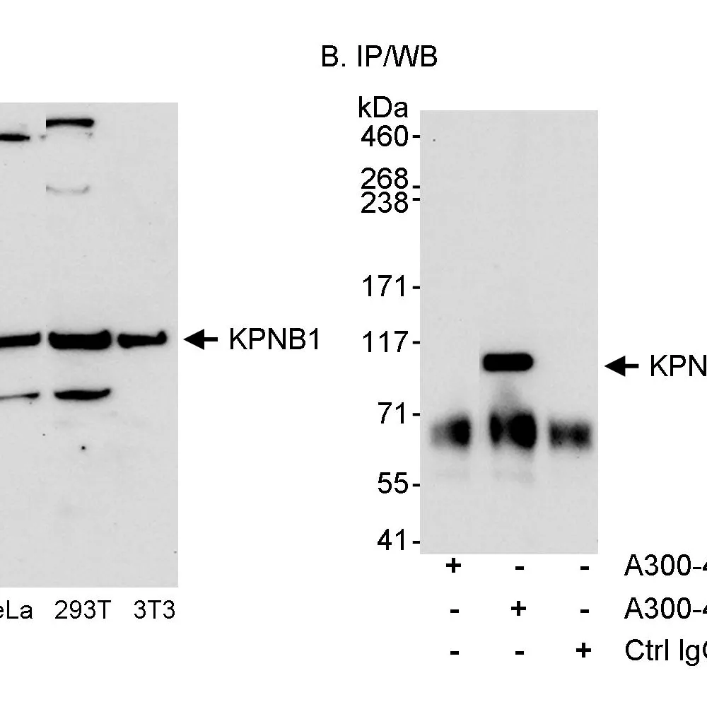 Rabbit anti-KPNB1 Antibody, Affinity Purified