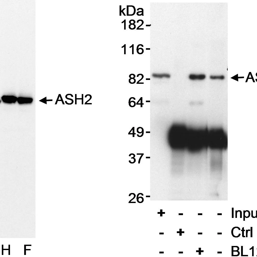 Rabbit anti-ASH2 Antibody, Affinity Purified
