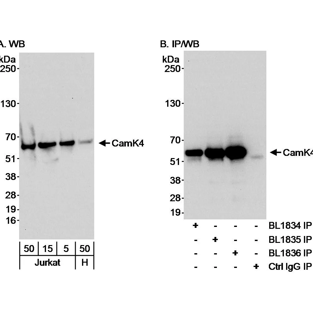 Rabbit anti-CamK4 Antibody, Affinity Purified