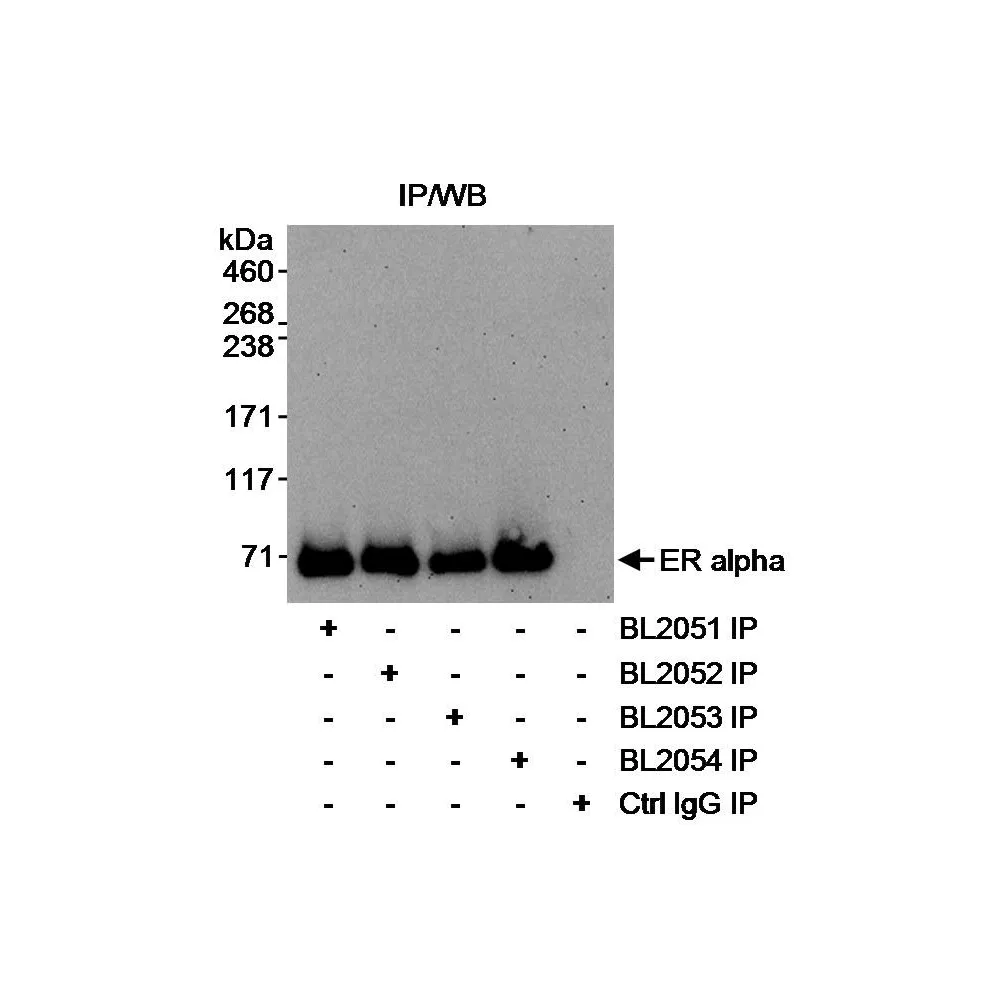 Rabbit anti-Estrogen Receptor Alpha Antibody, Affinity Purified