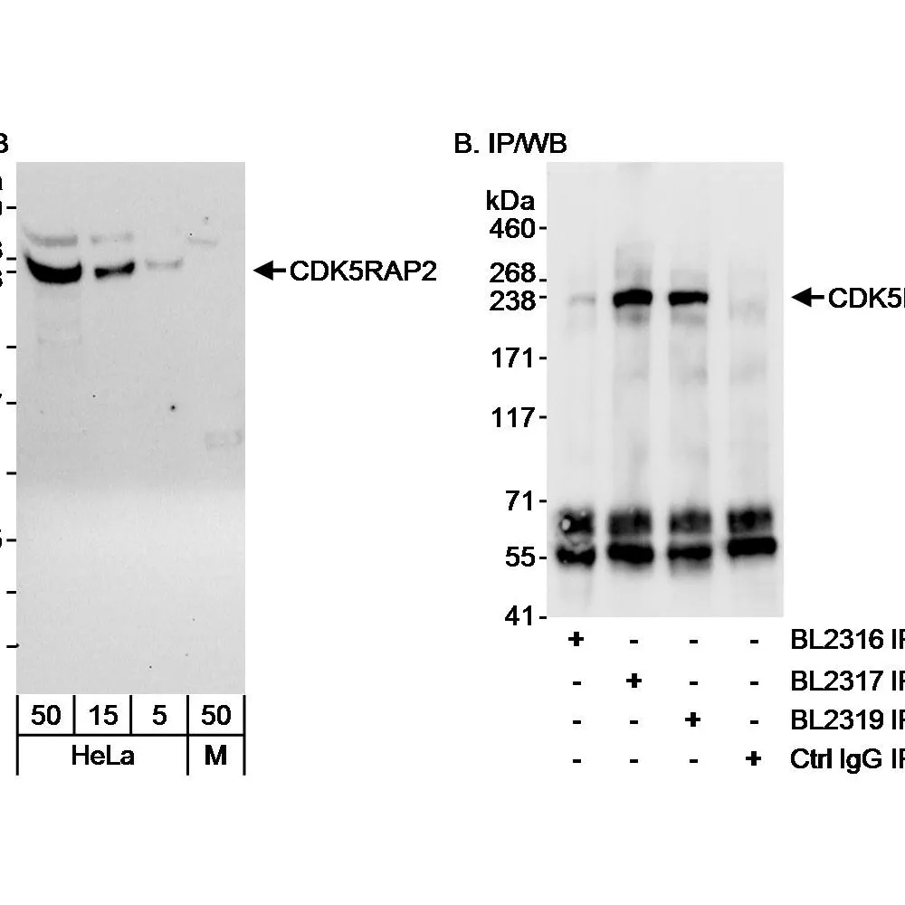 Rabbit anti-CDK5RAP2 Antibody, Affinity Purified