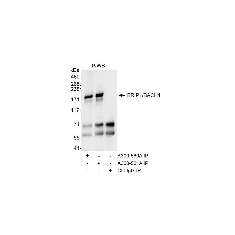 Rabbit anti-BRIP1/BACH1 Antibody, Affinity Purified