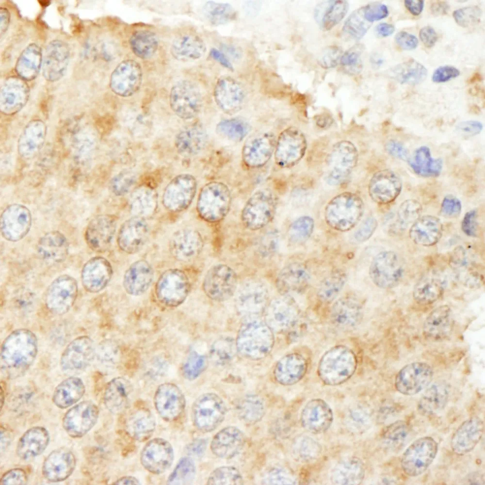 Rabbit anti-NF2 Antibody, Affinity Purified