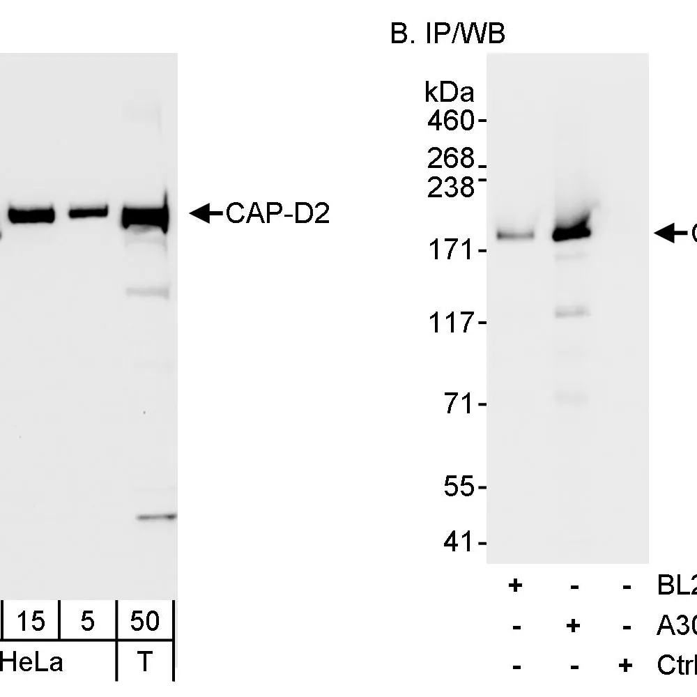 Rabbit anti-CAP-D2 Antibody, Affinity Purified