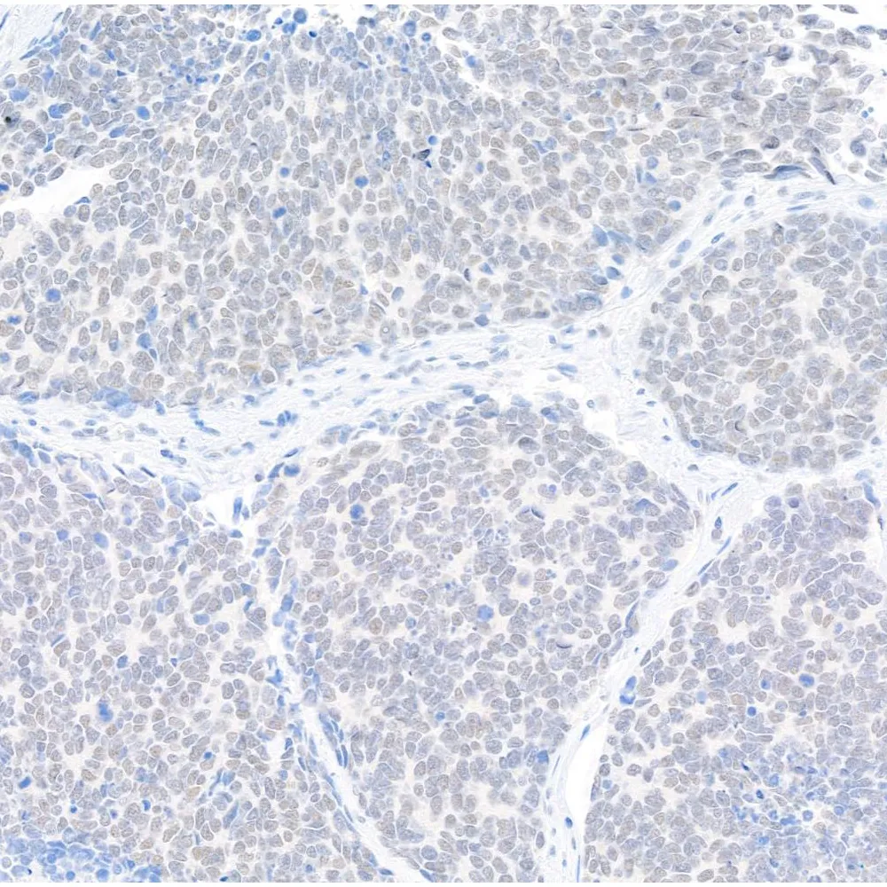 Rabbit anti-SKIV2L2 Antibody, Affinity Purified