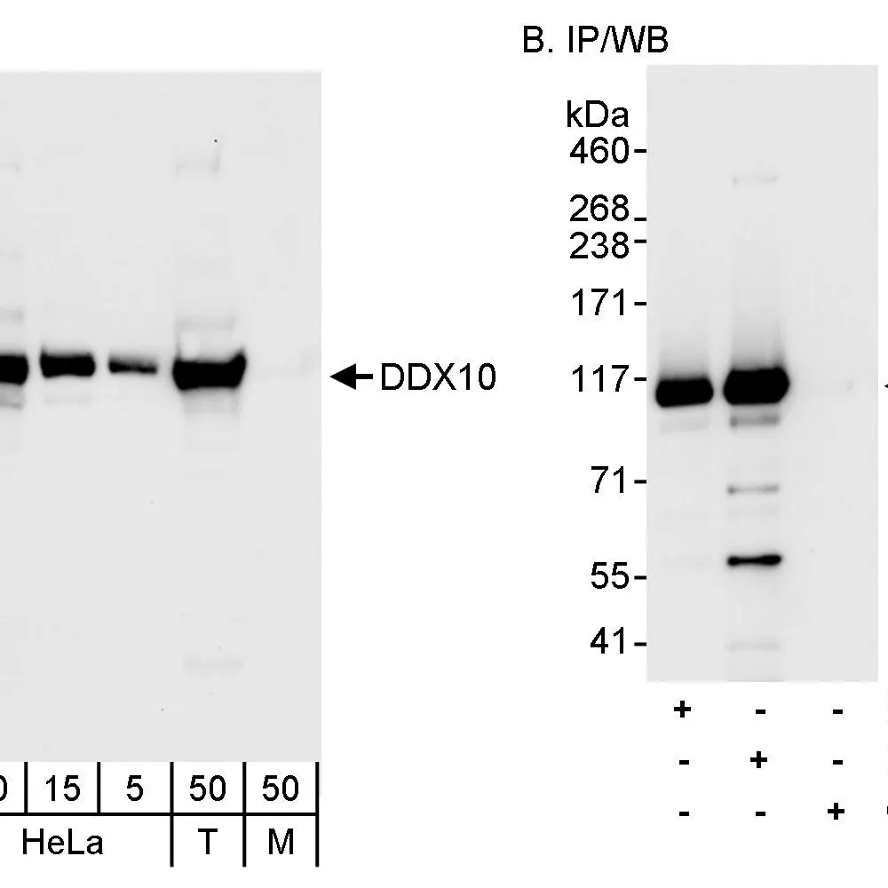 Rabbit anti-DDX10 Antibody, Affinity Purified