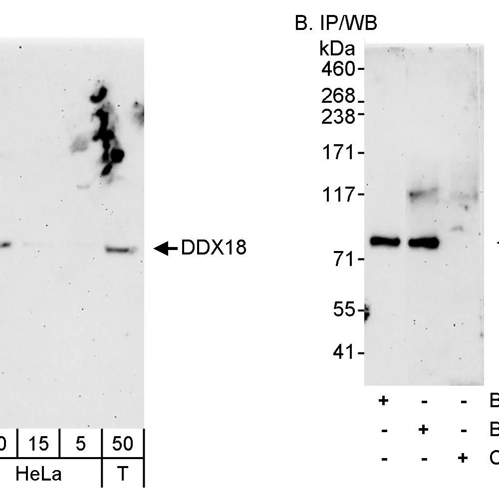 Rabbit anti-DDX18 Antibody, Affinity Purified