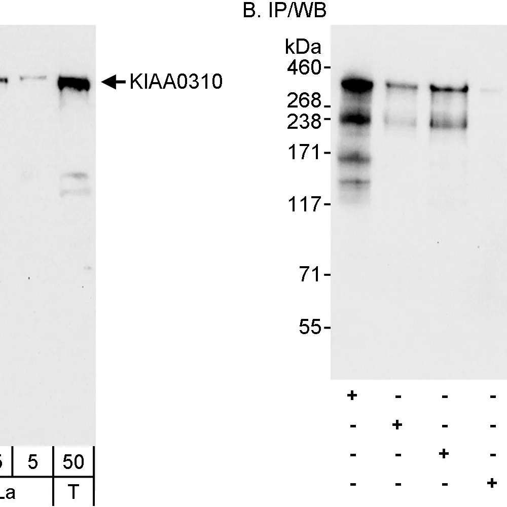Rabbit anti-KIAA0310 Antibody, Affinity Purified
