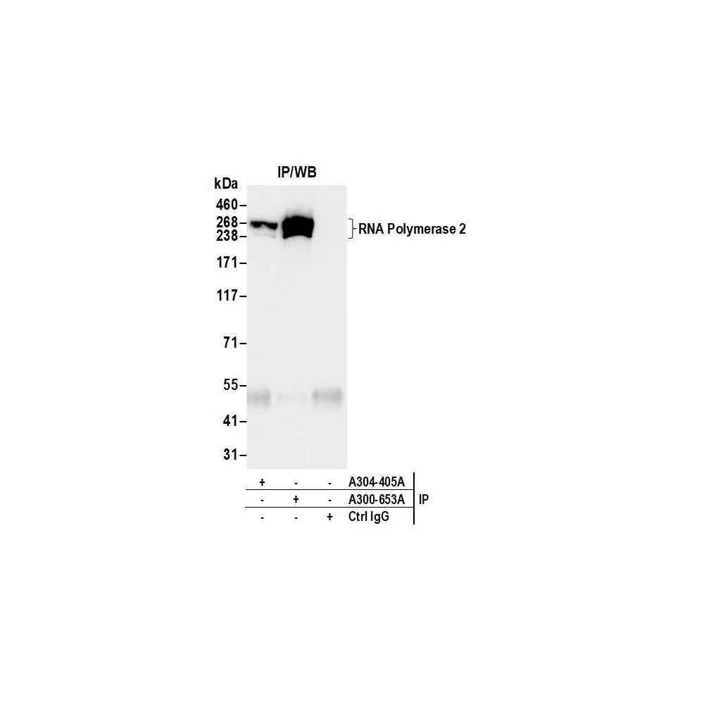 Rabbit anti-RNA Polymerase II Antibody, Affinity Purified