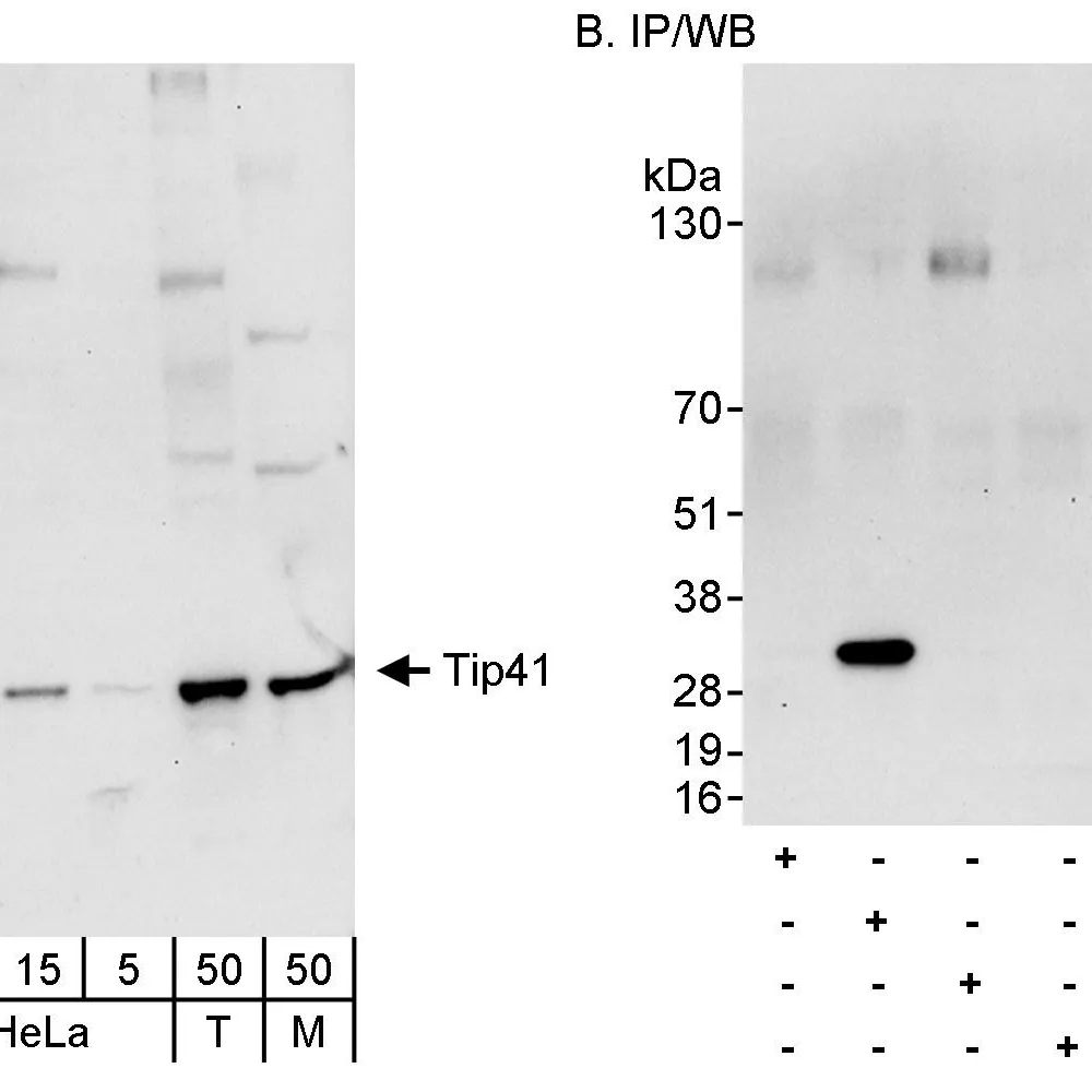 Rabbit anti-Tip41 Antibody, Affinity Purified