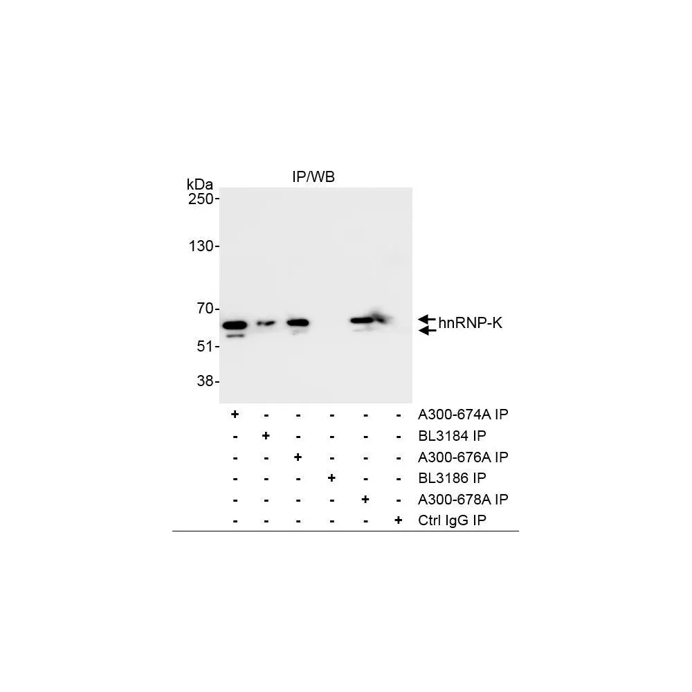 Rabbit anti-hnRNP-K Antibody, Affinity Purified