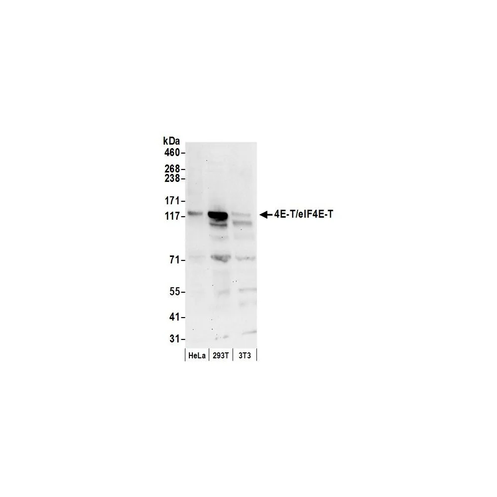 Rabbit anti-4E-T/eIF4E-T Antibody, Affinity Purified