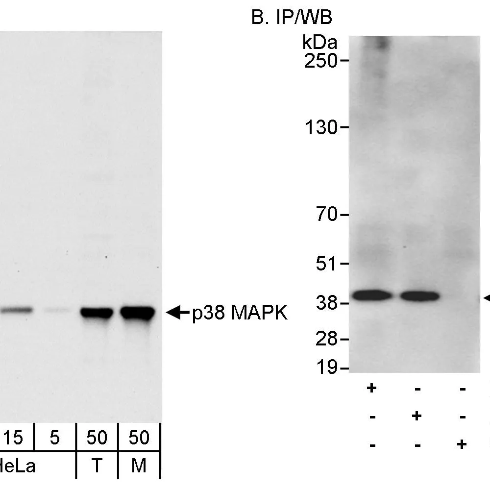 Rabbit anti-p38 MAPK Antibody, Affinity Purified