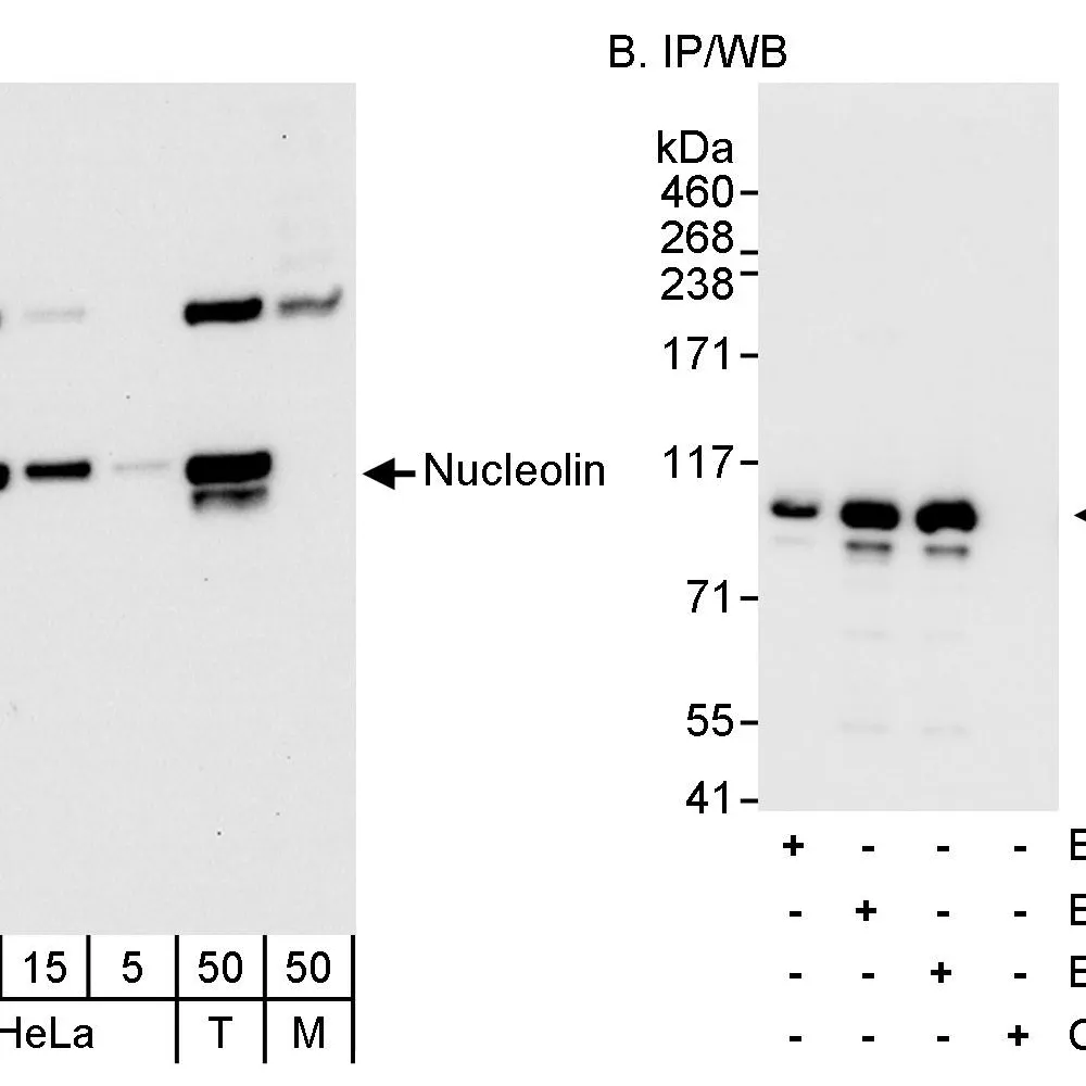 Rabbit anti-Nucleolin (NCL) Antibody, Affinity Purified