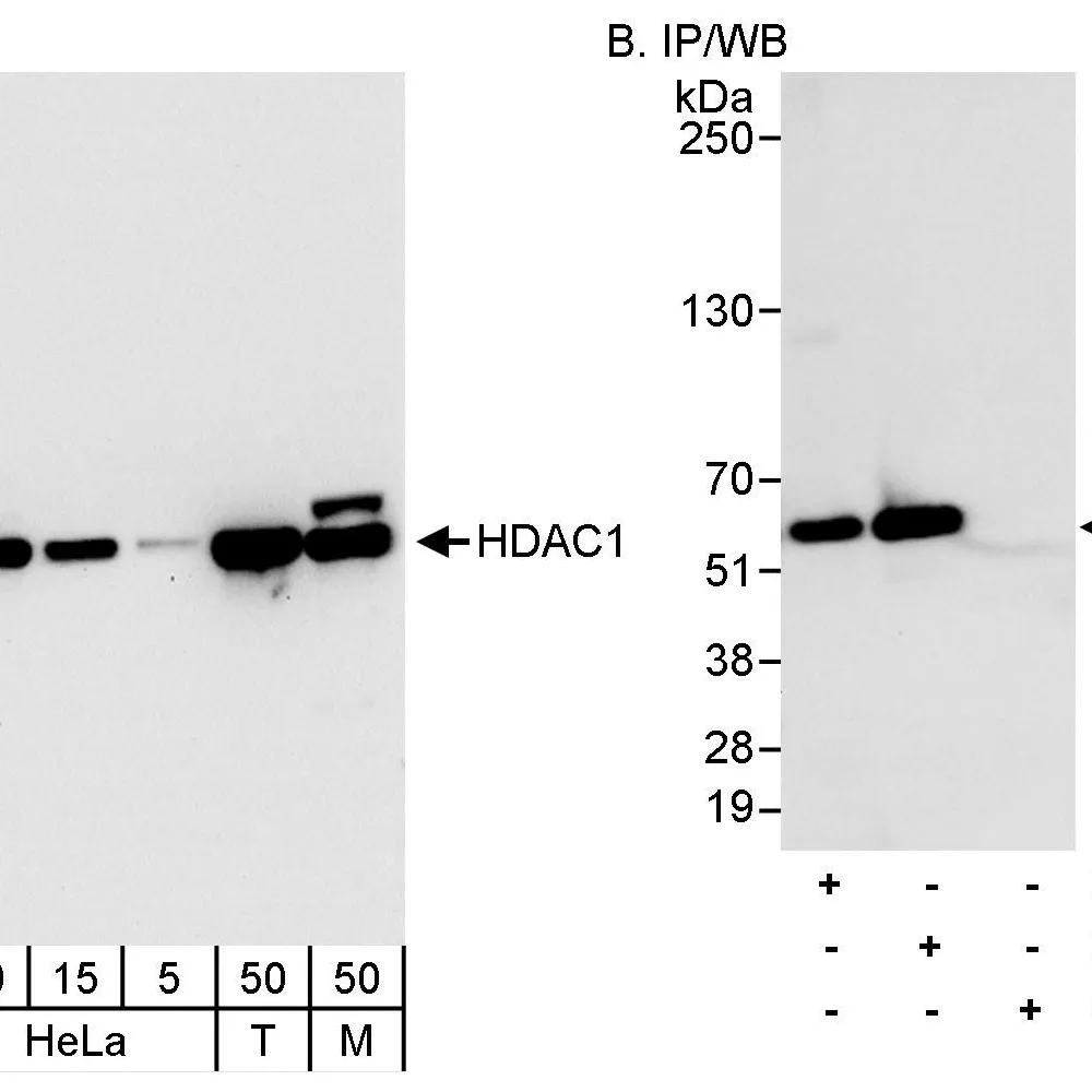 Rabbit anti-HDAC1 Antibody, Affinity Purified