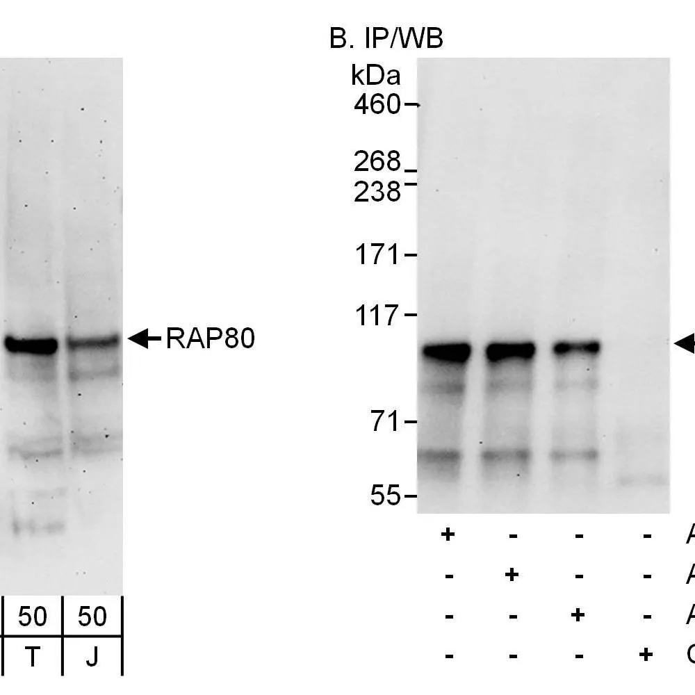 Rabbit anti-RAP80 Antibody, Affinity Purified