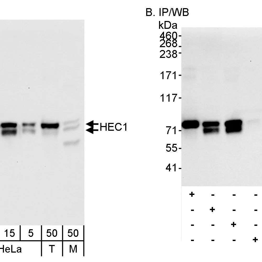 Rabbit anti-HEC1 Antibody, Affinity Purified