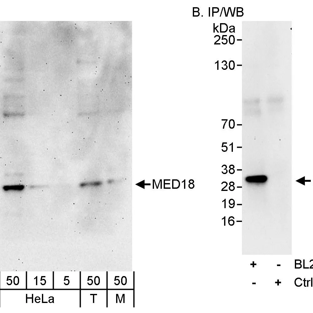Rabbit anti-MED18 Antibody, Affinity Purified