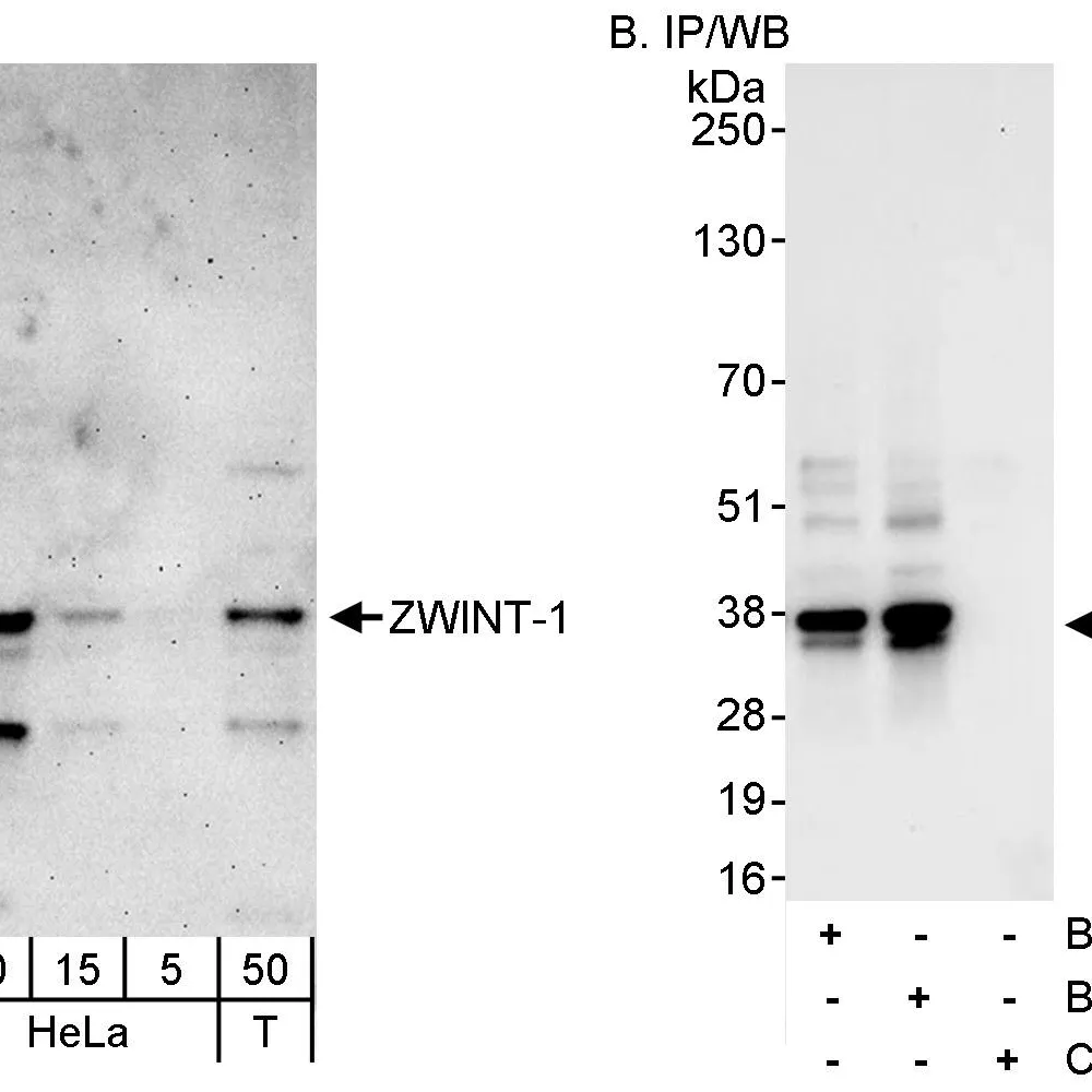 Rabbit anti-ZWINT-1 Antibody, Affinity Purified