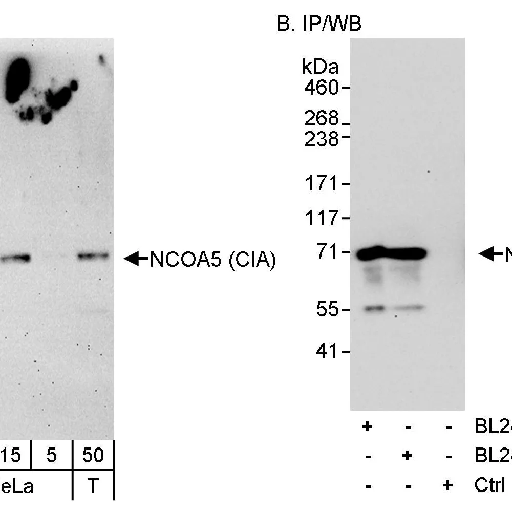 Rabbit anti-NCOA5/CIA Antibody, Affinity Purified