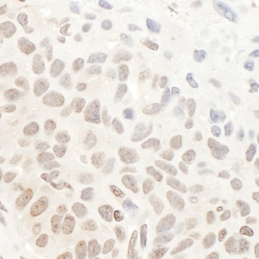 Rabbit anti-DHX33 Antibody, Affinity Purified