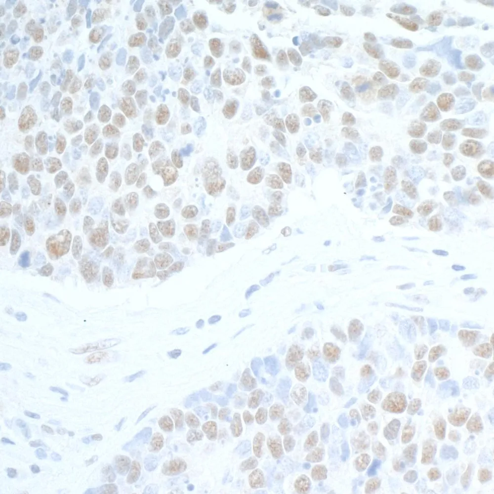 Rabbit anti-SUPT6H Antibody, Affinity Purified
