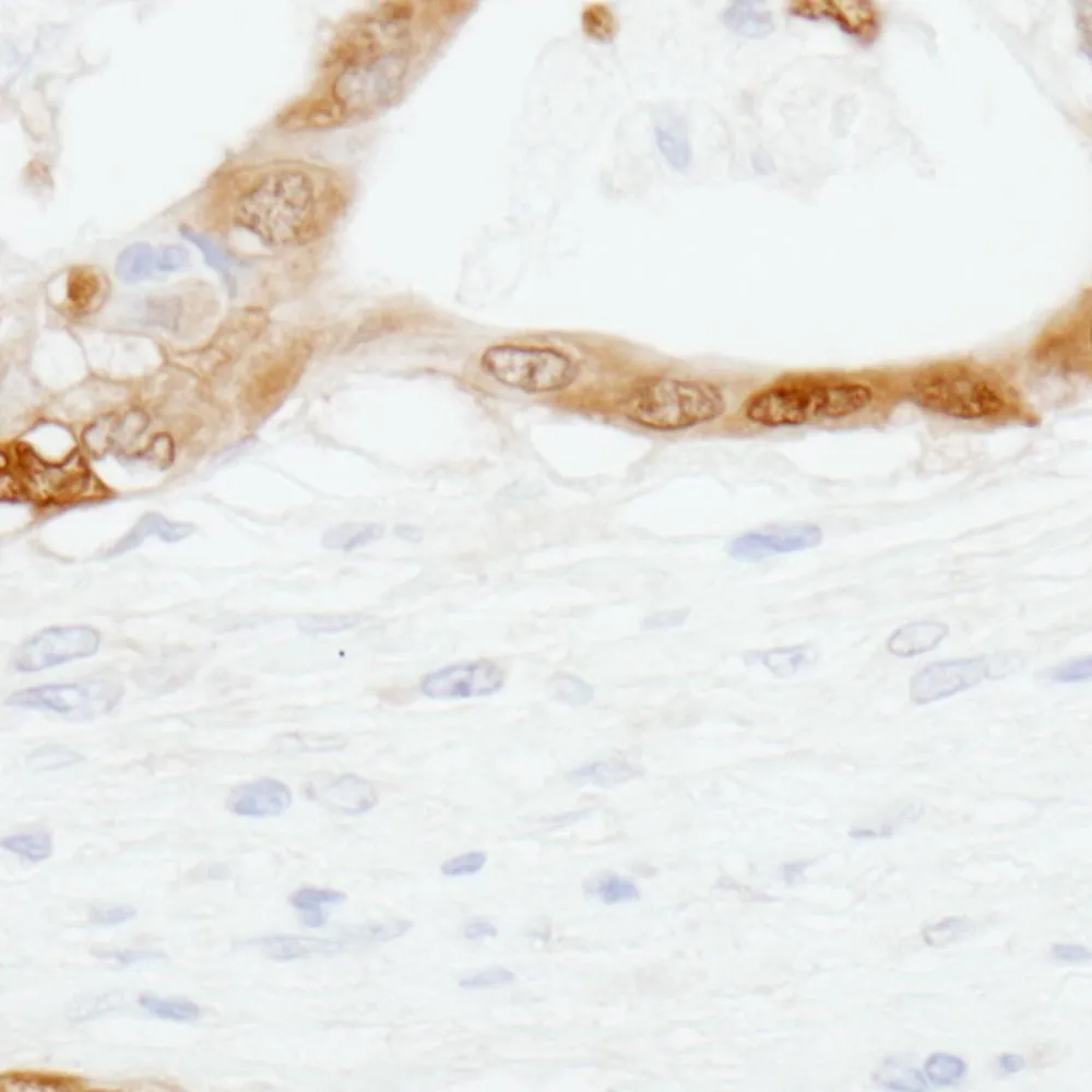 Rabbit anti-CRABP2 Antibody, Affinity Purified