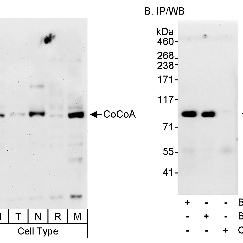 Rabbit anti-CoCoA Antibody, Affinity Purified