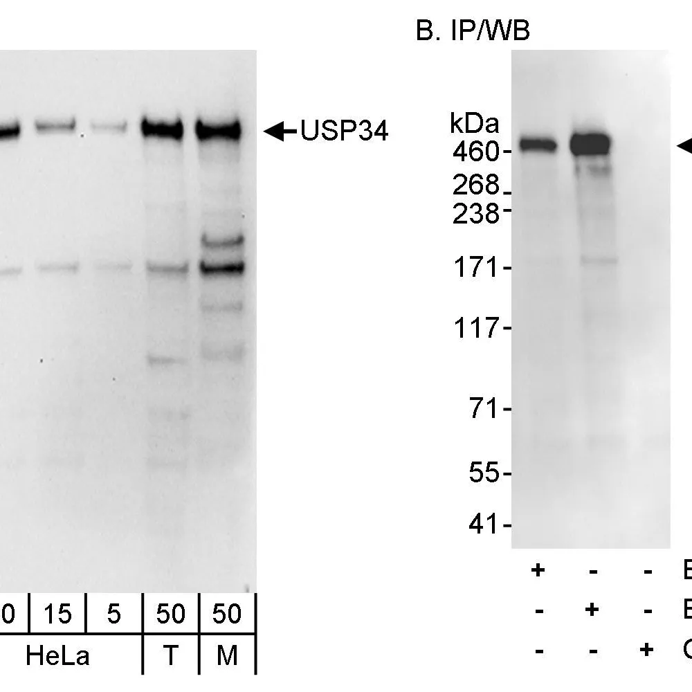 Rabbit anti-USP34 Antibody, Affinity Purified