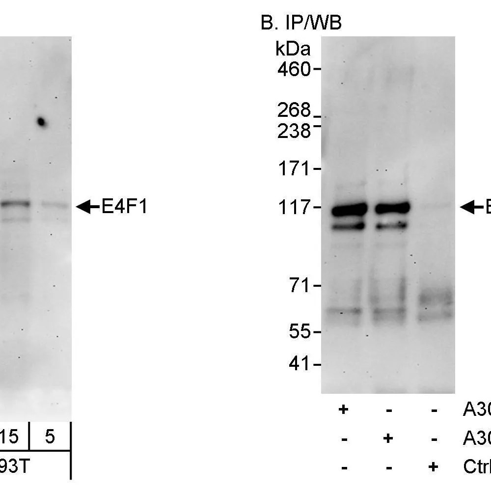 Rabbit anti-E4F1 Antibody, Affinity Purified