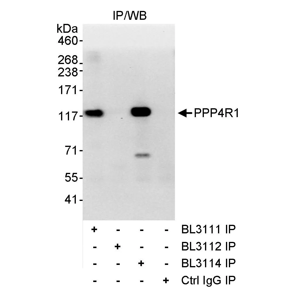 Rabbit anti-PPP4R1 Antibody, Affinity Purified